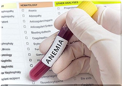 Anemia revealed by blood tests