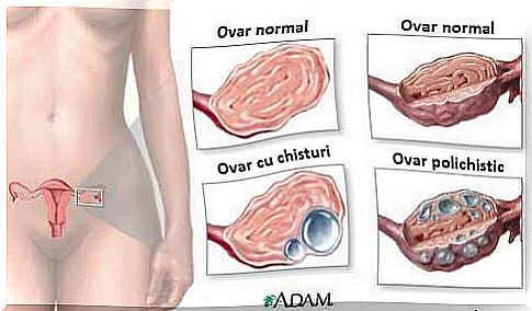 9 useful information about ovarian cysts