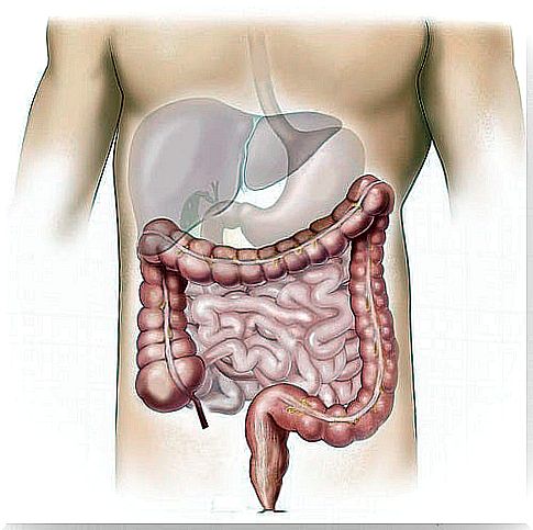 Anti-inflammatory foods for irritable bowel syndrome