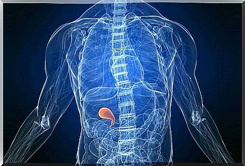 Diet after cholecystectomy (removal of iron)