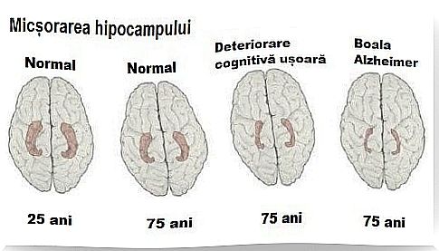 Early signs of Alzheimer's