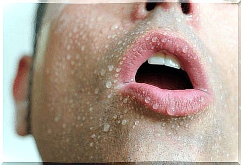 Excessive sweating can be caused by conditions such as anxiety