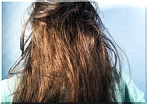 Oily hair that looks unpleasant