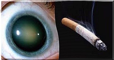 The need for natural remedies for cataracts for smokers