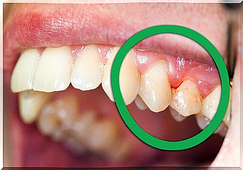 Oral cavity: diseases and treatments