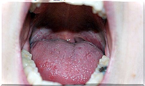 Diseases of the oral cavity