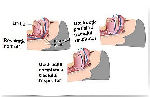 Snoring and its causes