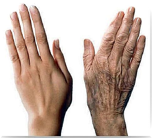 Tips to slow down the aging of your hands