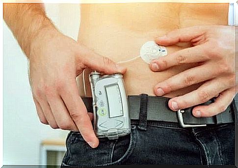 What is an insulin infusion pump?