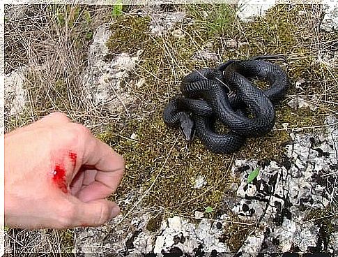 A person bitten by a snake